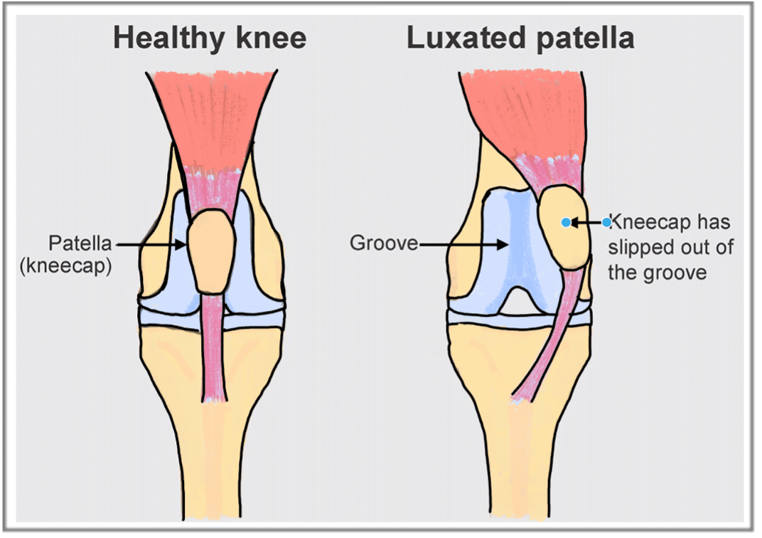 Patellar Luxation Southfields