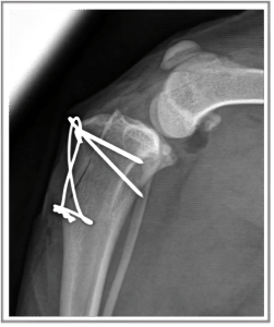 Patellar luxation in dogs - •	Tibial tuberosity transposition